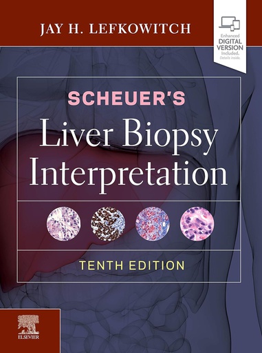 [B9780702075841] Scheuer's Liver Biopsy Interpretation: 10ed