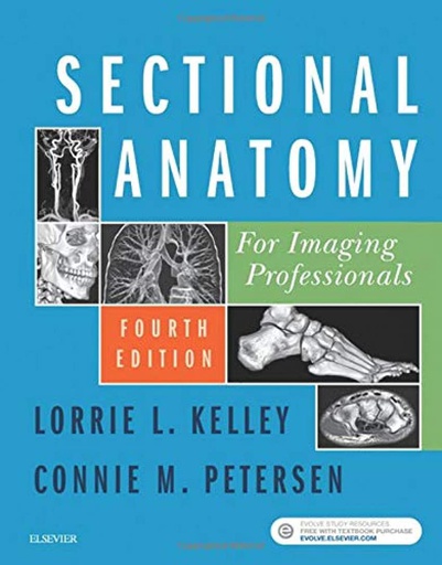 [B9780323414876] Sectional Anatomy for Imaging Professionals: 4ed