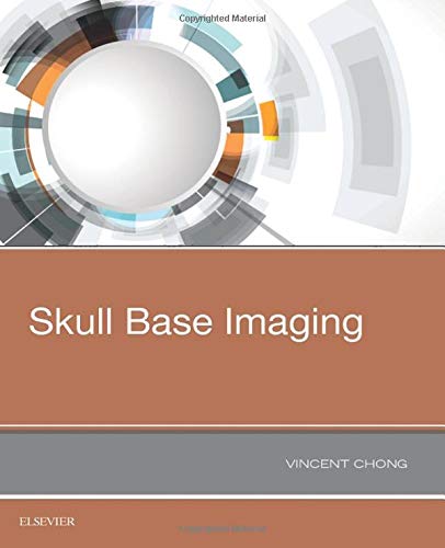 [B9780323485630] Skull Base Imaging: 1ed