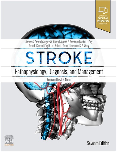 [B9780323694247] Stroke: Pathophysiology, Diagnosis, and Management 7ed