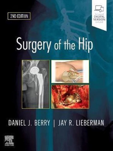 [B9780323554640] Surgery of the Hip: 2ed