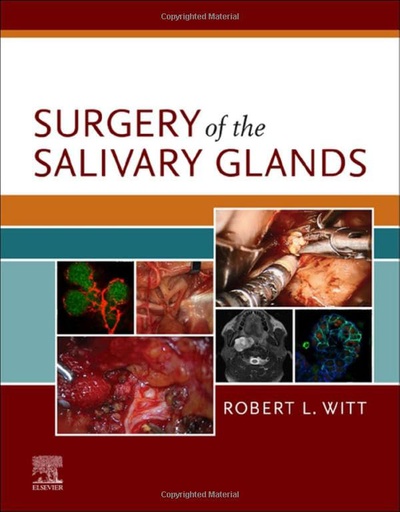 [B9780323672368] Surgery of the Salivary Glands: 1ed