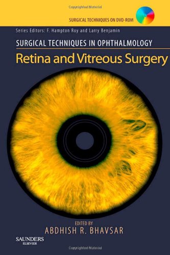 [B9781416042068] Surgical Techniques in Ophthalmology Series: Retina and Vitreous Surgery: Text with DVD 1ed