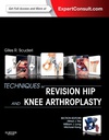 Techniques in Revision Hip and Knee Arthroplasty: 1ed