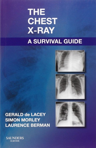 [B9780702030468] The Chest X-Ray: A Survival Guide: 1ed