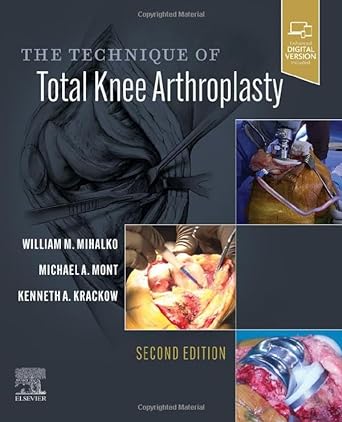 [B9780323713023] The Technique of Total Knee Arthroplasty: 2ed