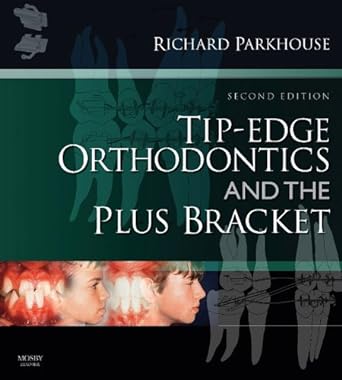 [B9780723434818] Tip-Edge Orthodontics and the Plus Bracket: 2ed