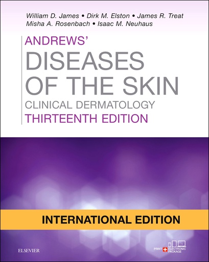 [B9780323547543] Andrews' Diseases of the Skin: Clinical Dermatology, IE, 13/e