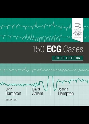 [B9780702074585] 150 ECG Cases: 5ed