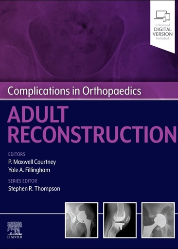 [B9780323824378] Complications in Orthopaedics: Adult Reconstruction: 1ed