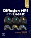 Diffusion MRI of the Breast: 1ed