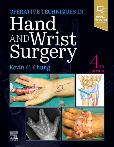 [B9780323794152] Operative Techniques: Hand and Wrist Surgery: 4ed