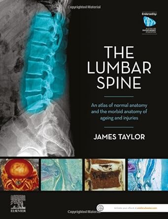 [B9780729543132] The Lumbar Spine: An Atlas of Normal Anatomy and the Morbid Anatomy of Ageing and Injury 1ed