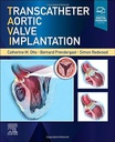 Transcatheter Aortic Valve Implantation: 1ed