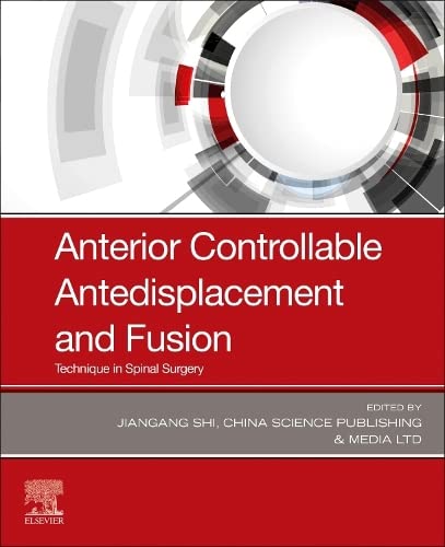 [B9780323880497] Anterior Controllable Antedisplacement and Fusion: Technique in Spinal Surgery 1ed