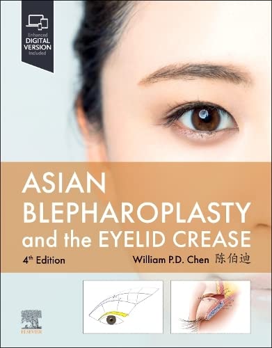 [B9780323878760] Asian Blepharoplasty and the Eyelid Crease: 4ed