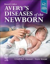 Avery's Diseases of the Newborn: 11ed