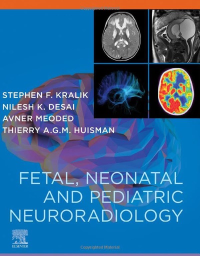 [B9780323796958] Fetal, Neonatal and Pediatric Neuroradiology Companion: 1ed