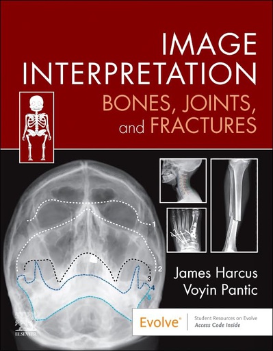 [B9780323870801] Image Interpretation: Bones, Joints, and Fractures: 1ed