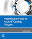 Multimodal Imaging Atlas of Cardiac Masses: 1ed