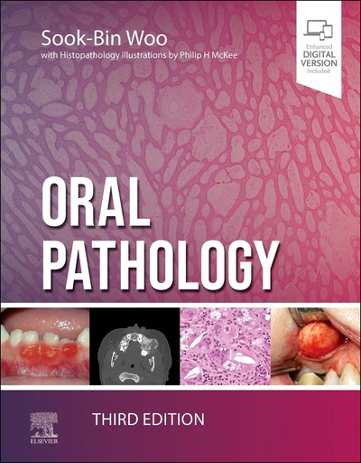 [B9780323829182] Oral Pathology: 3ed