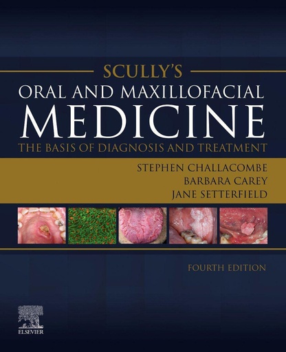 [B9780702080111] Scully’s Oral and Maxillofacial Medicine: The Basis of Diagnosis and Treatment: The Basis of Diagnosis and Treatment 4ed