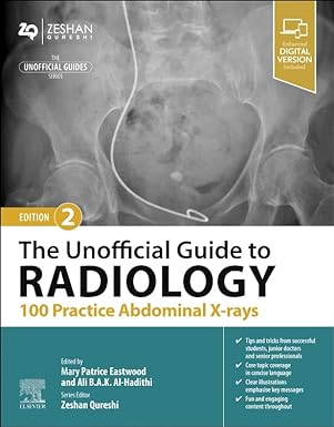 [B9780443109188] The Unofficial Guide to Radiology: 100 Practice Abdominal X Rays: 3ed