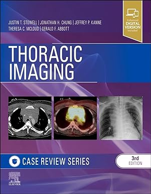 [B9780323428798] Thoracic Imaging: Case Review: 3ed