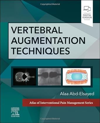 [B9780323882262] Vertebral Augmentation Techniques: 1ed