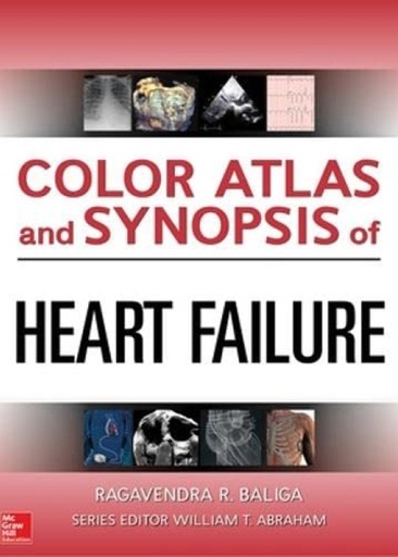 [B9780071749381] COLOR ATLAS & SYNOPSIS OF HEART FAILURE