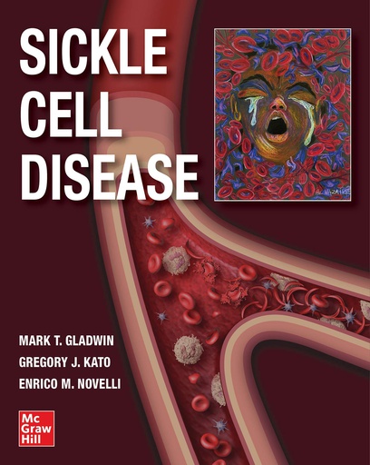 [B9781260458596] SICKLE CELL DISEASE