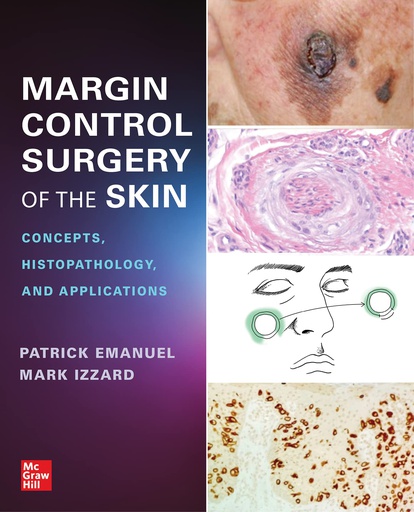 [B9781264285990] MARGIN CONTROL SURGERY OF THE SKIN