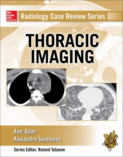 [B9780071818087] RADIOLOGY CASE REVIEW SRS: THORACIC IMAGING