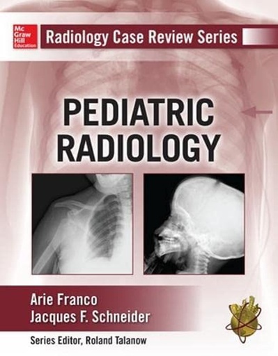 [B9780071775489] RADIOLOGY CASE REVIEW SRS: PEDIATRIC