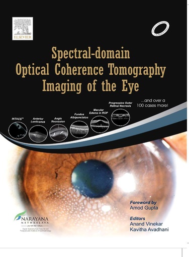 [B9788131230527] Spectral Domain Optical Coherence Tomography Imaging of the Eye, 1e