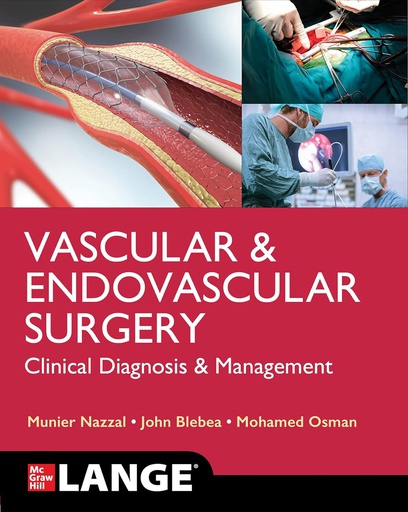 [B9781260462715] LANGE VASCULAR AND ENDOVASCULAR SURGERY: CLINICAL DIAGNOSIS & MANAGEMENT