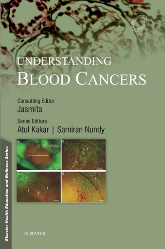 [B9788131249758] Understanding Blood Cancers, 1/e