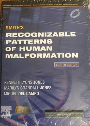 [B9788131270264] Smith's Recognizable Patterns of Human Malformation, 8/e-SAE