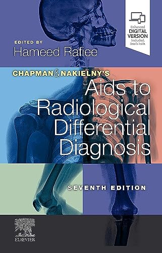 [B9780702075391] Chapman and Nakielny's Aids to Radiological Differential Diagnosis, 7/e