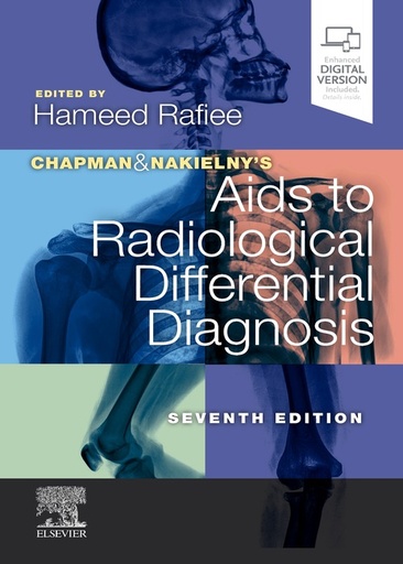 [B9780702075391] Chapman and Nakielny's Aids to Radiological Differential Diagnosis, 7/e