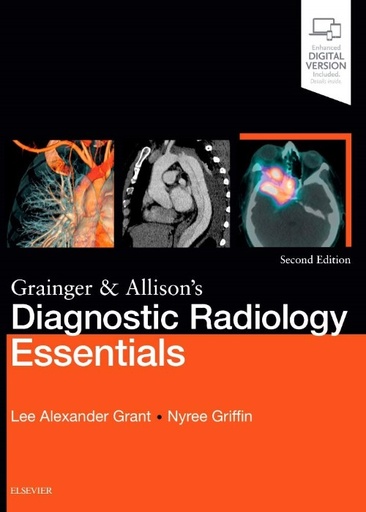 [B9780702073113] Grainger and Allison's Diagnostic Radiology Essentials: Expert Consult: Online and Print, 2/e