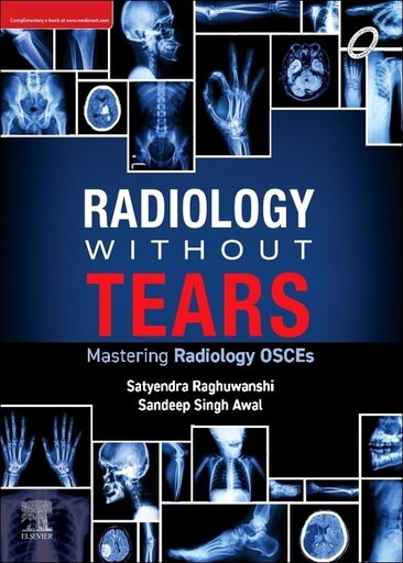 [B9788131269398] Radiology Without Tears: Mastering Radiology OSCEs