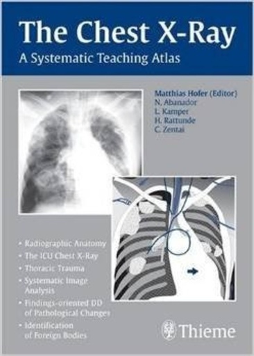 [B9783131449719] The Chest X-Ray: A Systematic Teaching Atlas (Asian Edition)